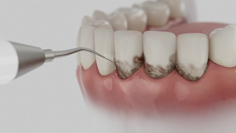 Reliable Dental Implants contractor in Rio Communities, NM by Smile Center Dentistry